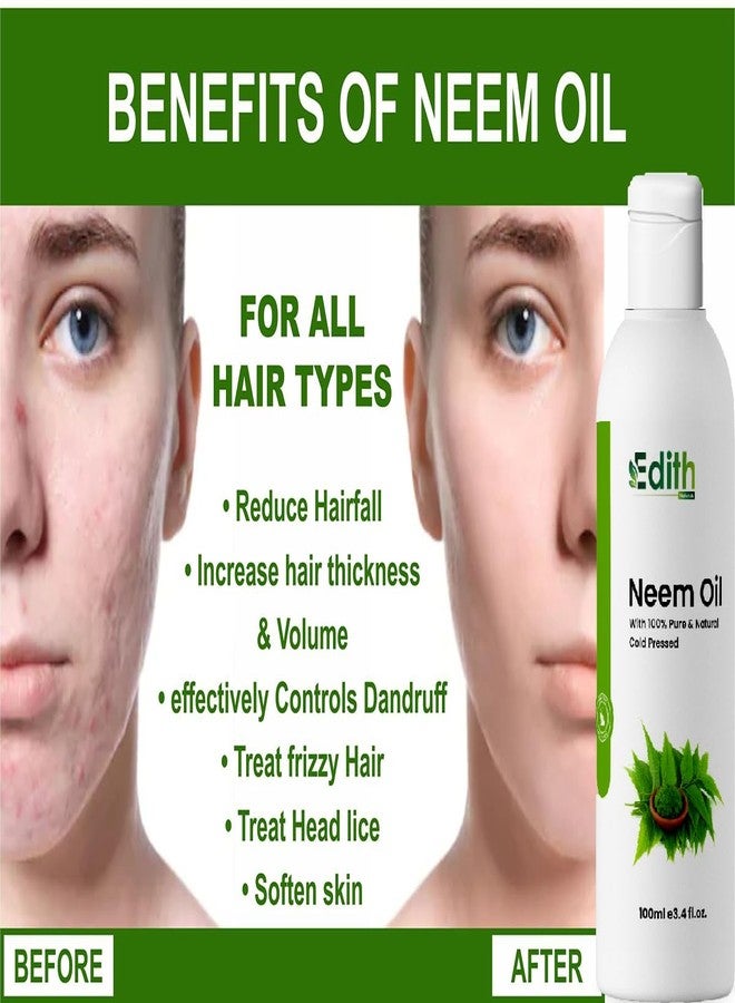 EDITH زيت النيم النقي متعدد الأغراض من إديث ناتشورال للشعر والبشرة - يزيل البثور وحب الشباب ويعالج أي عدوى فطرية من الجلد 100 مل (2) - Image 2