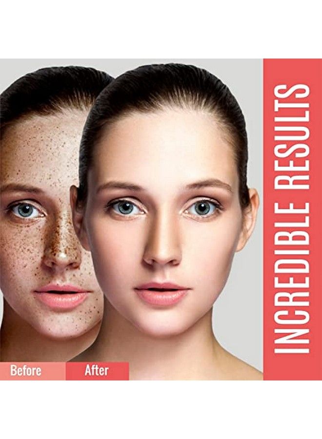 dermaxgen Dark Spot Corrector For Face And Body Hyperpigmentation Treatment Uneven Skin Tone Corrector For Face Body Underarmsinner Thigh For All Skin Types For Men Women  1.7 Fl Oz - Image 5