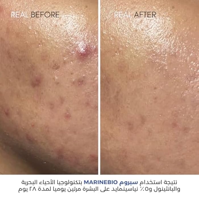 Nut Botanicals Marinebio 5% Niacinamide Serum With Panthenol B5 & Postbiotic Complex 30 Ml - Image 4