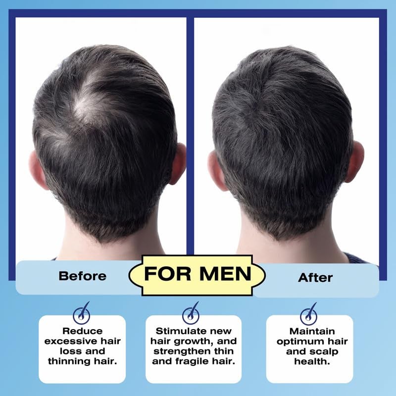 Mediceuticals Numinox - Mediceuticals Follicle Revitalizer 8.45 oz (250 ml) DHT Blocker for Men â€“ DHT Blocker for Women - Sudden Hair Loss - Telogen Effluvium - Hair Follicle and Scalp Stimulator - Image 5