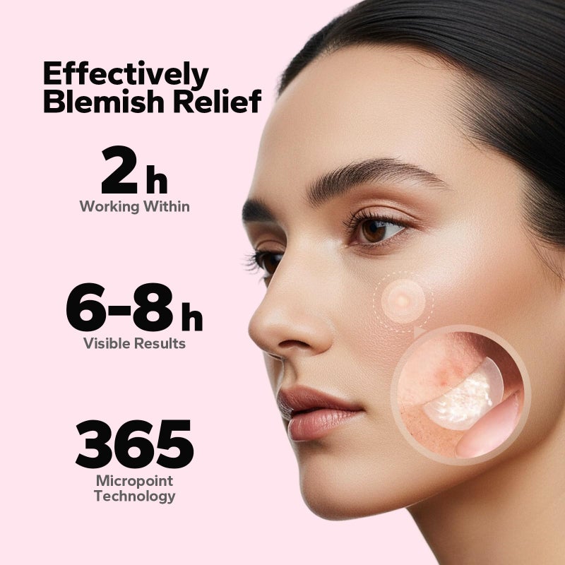 CharmCherry Pimple Patches for Face (18 Count), Microdart Acne Patches, Hydrocolloid Blemish Spot with Salicylic Acid, Fast-Acting for Early Stage Deep Pimples, Zits, Breakouts & Cystic Acne - Image 5