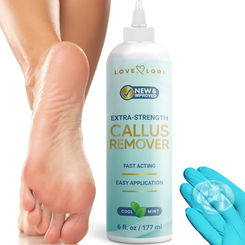 Love, Lori Callus Remover for Feet (Extra Strength) Foot Callus Remover Gel - Feet Scrubber, Pedicure Spa Tools, 6oz - Image 1