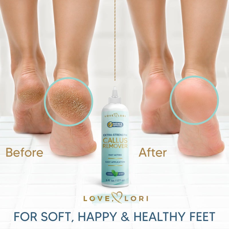 Love, Lori Callus Remover for Feet (Extra Strength) Foot Callus Remover Gel - Feet Scrubber, Pedicure Spa Tools, 6oz - Image 3