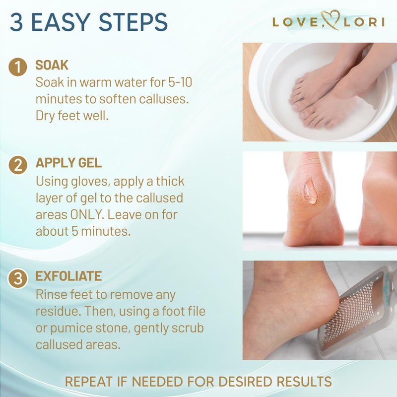 Love, Lori Callus Remover for Feet (Extra Strength) Foot Callus Remover Gel - Feet Scrubber, Pedicure Spa Tools, 6oz - Image 4