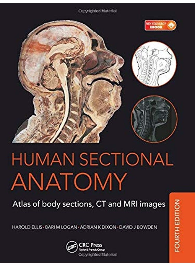 Human Sectional Anatomy Atlas Of Body Sections Ct And Mri Images Fourth Edition 