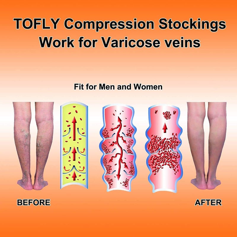TOFLY ® Calf Compression Sleeve for Men & Women, 1 Pair, Footless Compression Socks 20-30mmHg for Leg Support, Shin Splint, Pain Relief, Swelling, Varicose Veins, Maternity, Nursing, Travel, Beige S - Image 4