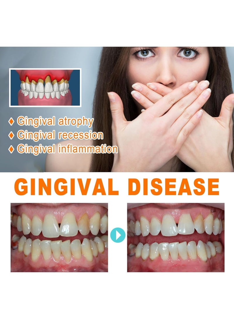 EELHOE Gum Repair Serum Ampoules – Advanced Natural Formula for Gum Healing, Inflammation Reduction, and Complete Oral Care Support - Image 3