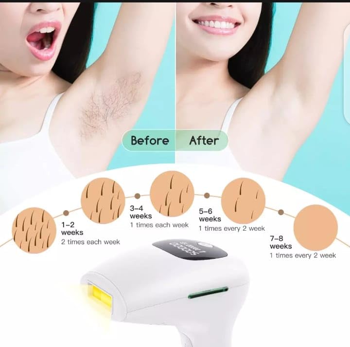 ZAMZIN Permanent Laser Hair Removal Device for Men & Women/Painless Full Body, Face, Bikini & Legs, Cordless Advanced Pulse Light Technology,Ergonomic, Portable Epilator for Home & Travel Use - Image 5