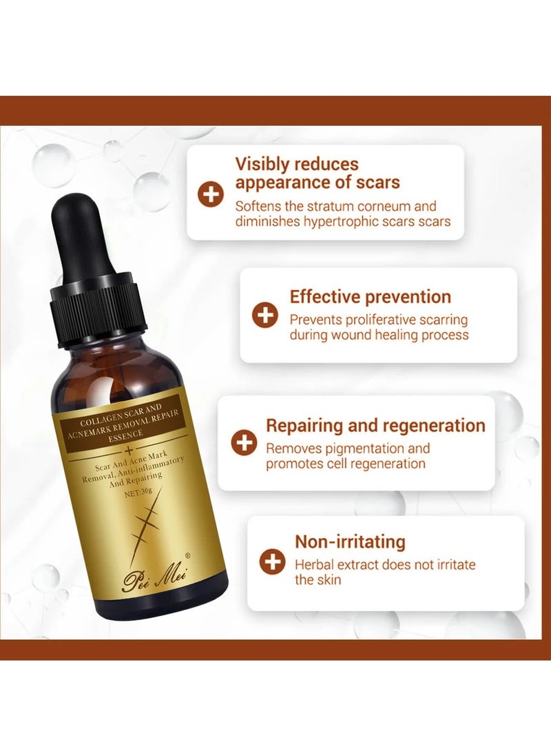 Pei Mei Collagen Scar and Acne Mark Removal Repair Essence Moisturizing Soothing Facial Scar Removal Serum Collagen Skincare Serum Stretch Marks Serum Skin Repair Nourishing Serum Fat Streaks Removal Serum  - Image 2