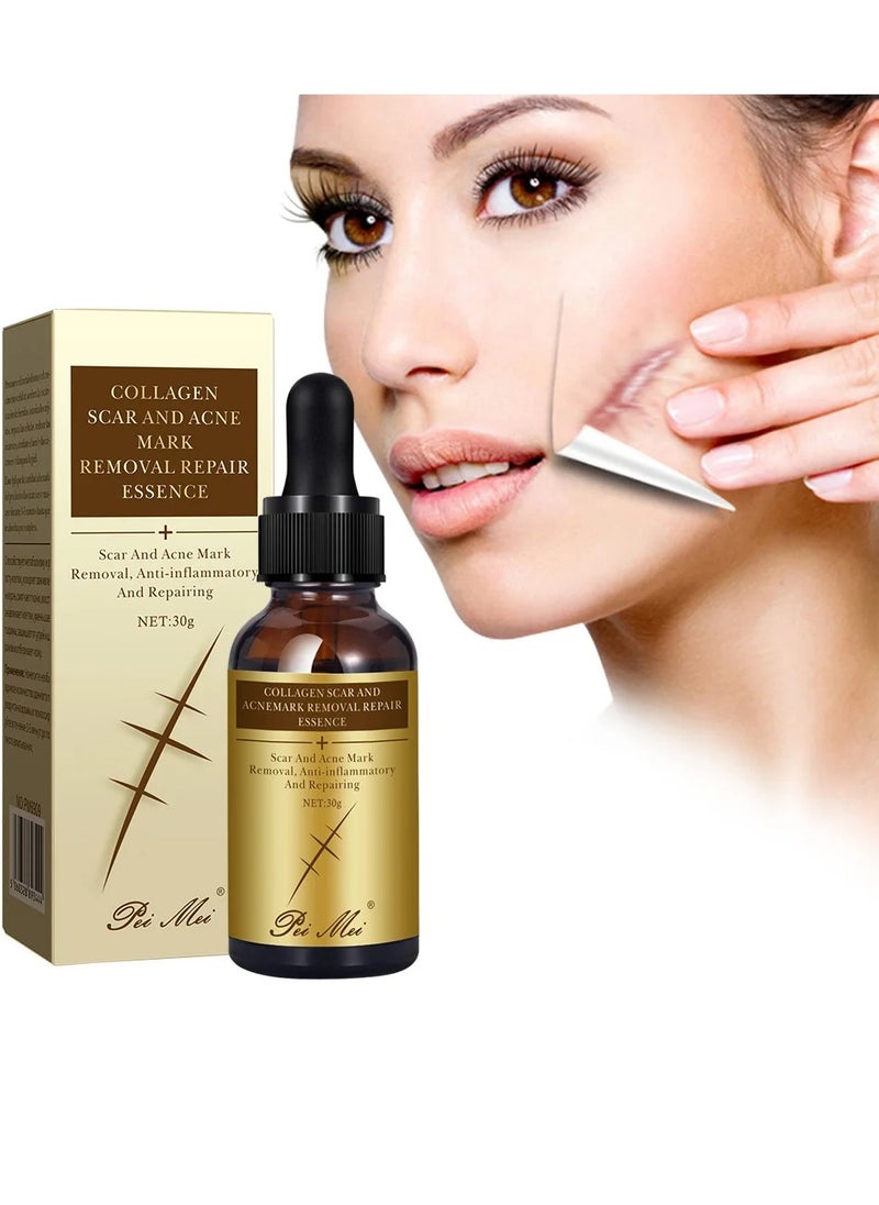 Pei Mei Collagen Scar and Acne Mark Removal Repair Essence Moisturizing Soothing Facial Scar Removal Serum Collagen Skincare Serum Stretch Marks Serum Skin Repair Nourishing Serum Fat Streaks Removal Serum  - Image 3