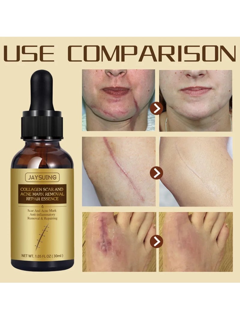 Pei Mei Collagen Scar and Acne Mark Removal Repair Essence Moisturizing Soothing Facial Scar Removal Serum Collagen Skincare Serum Stretch Marks Serum Skin Repair Nourishing Serum Fat Streaks Removal Serum  - Image 4