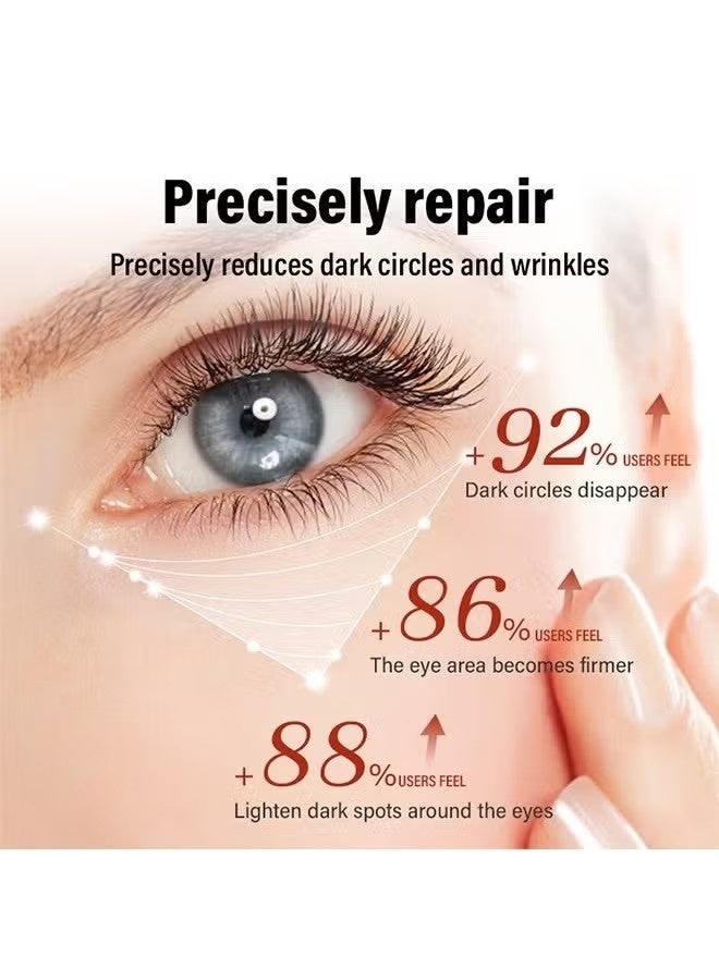 MOIKA Retinol Repair Eye Cream-For Dark Circles and Puffiness, with AHA and BHA Dark Circle Fine Lines Treatment,Anti-aging, Under Eye Treatment,Reduces Wrinkles, Defoams and Brightens Skin 30g - Image 3