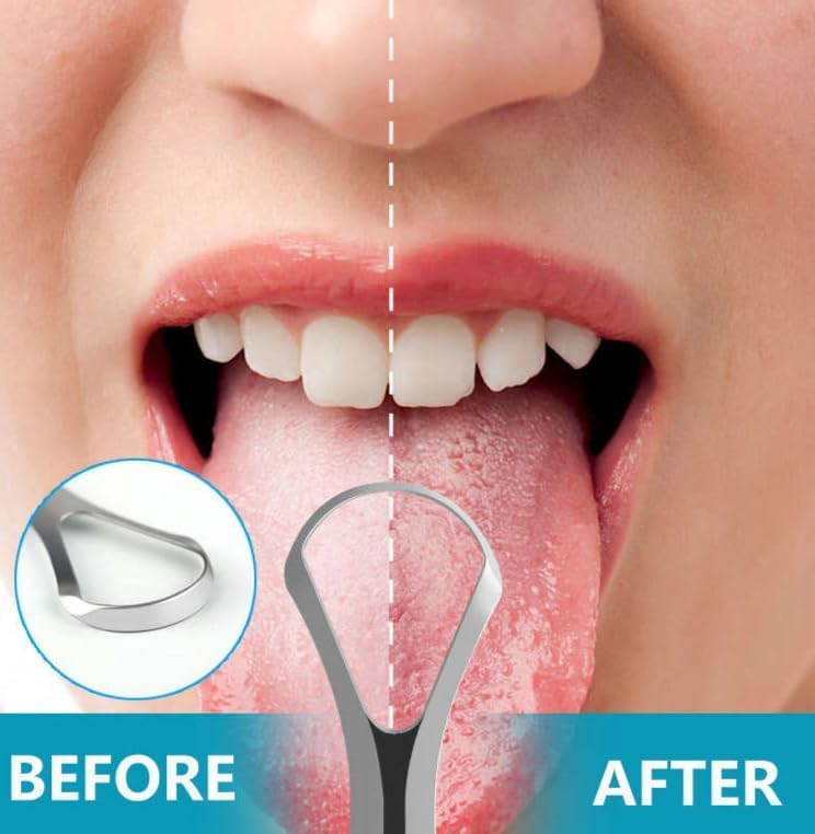 SMARAN Tongue Scraper - Stainless Steel Tongue Cleaner for Adults & Kids | Oral Care Tool to Reduce Bad Breath | Durable Metal Tongue Scraper for Fresh Breath & Daily Hygiene (PACK OF 2) - Image 4