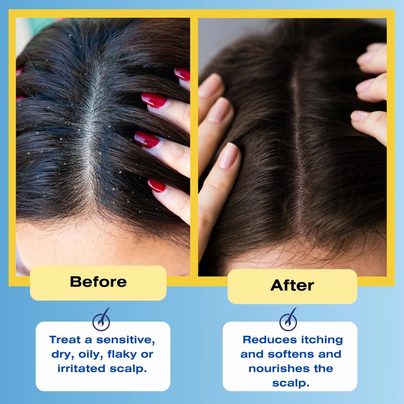 Mediceuticals Therapeutic Conditioner â€“ All Skin Types â€“ Sensitive Dry Scalp â€“ Oily Scalp - Reduces Itching - Flaky Scalp 8.45oz (250ml) - Image 5