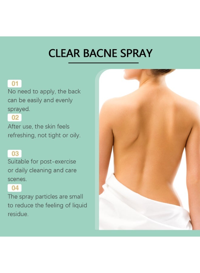 OUHOE Bacne Spray for Back Acne – Salicylic Acid & Witch Hazel Formula – Soothes & Hydrates – Fast-Acting, Non-Irritating, Safe for Teens & Adults – For All Skin Types - Image 2
