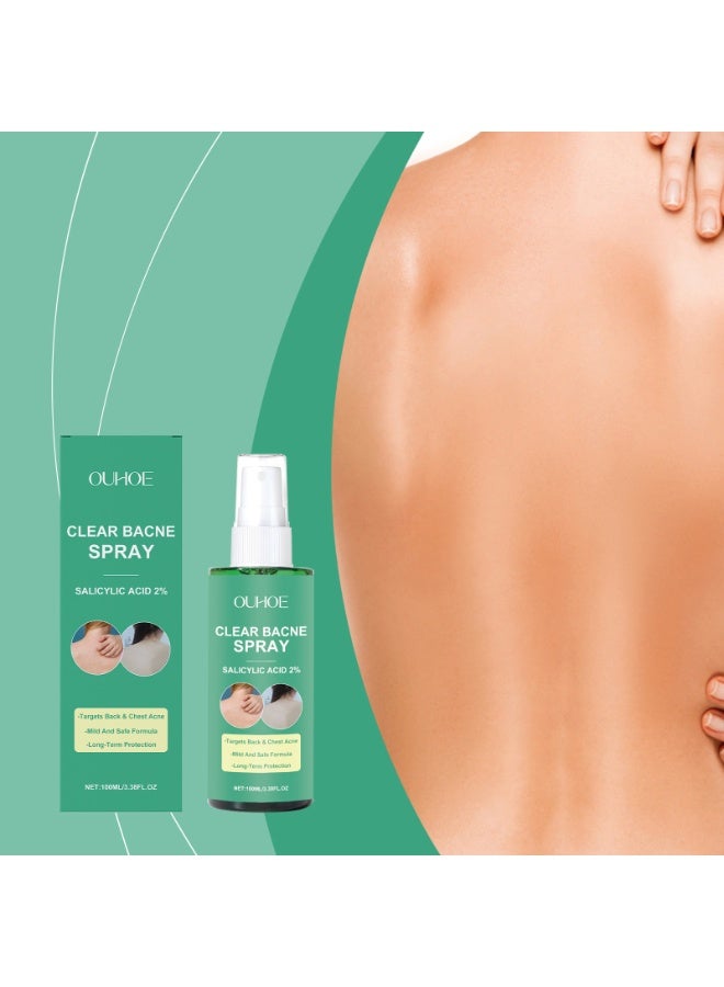 OUHOE Bacne Spray for Back Acne – Salicylic Acid & Witch Hazel Formula – Soothes & Hydrates – Fast-Acting, Non-Irritating, Safe for Teens & Adults – For All Skin Types - Image 3