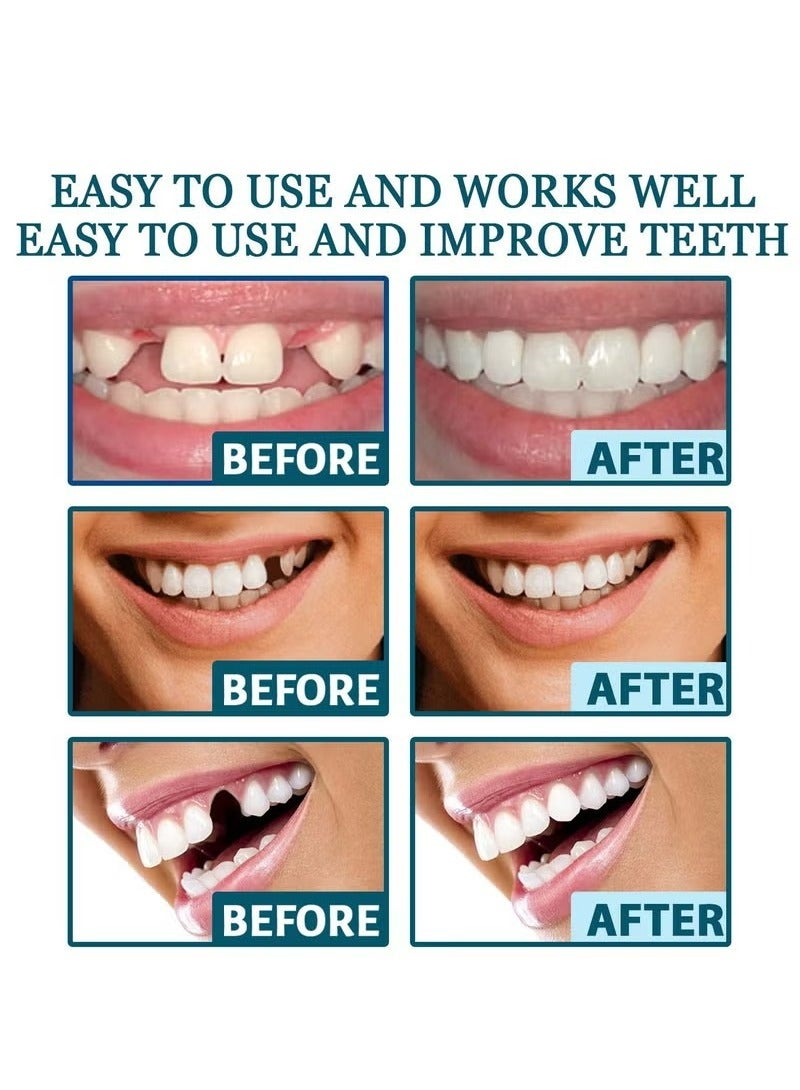 EELHOE 1 Pairs Temporary Teeth Perfect Cover, Cosmetic Veneers Teeth Temporary Dentures, Adjustable Snap On, Moldable False Teeth for Beautiful Smile, Nature and Comfortable, Fit Whitening Flex Denture Cover，Teeth Veneers Whitening Dentures - Image 2