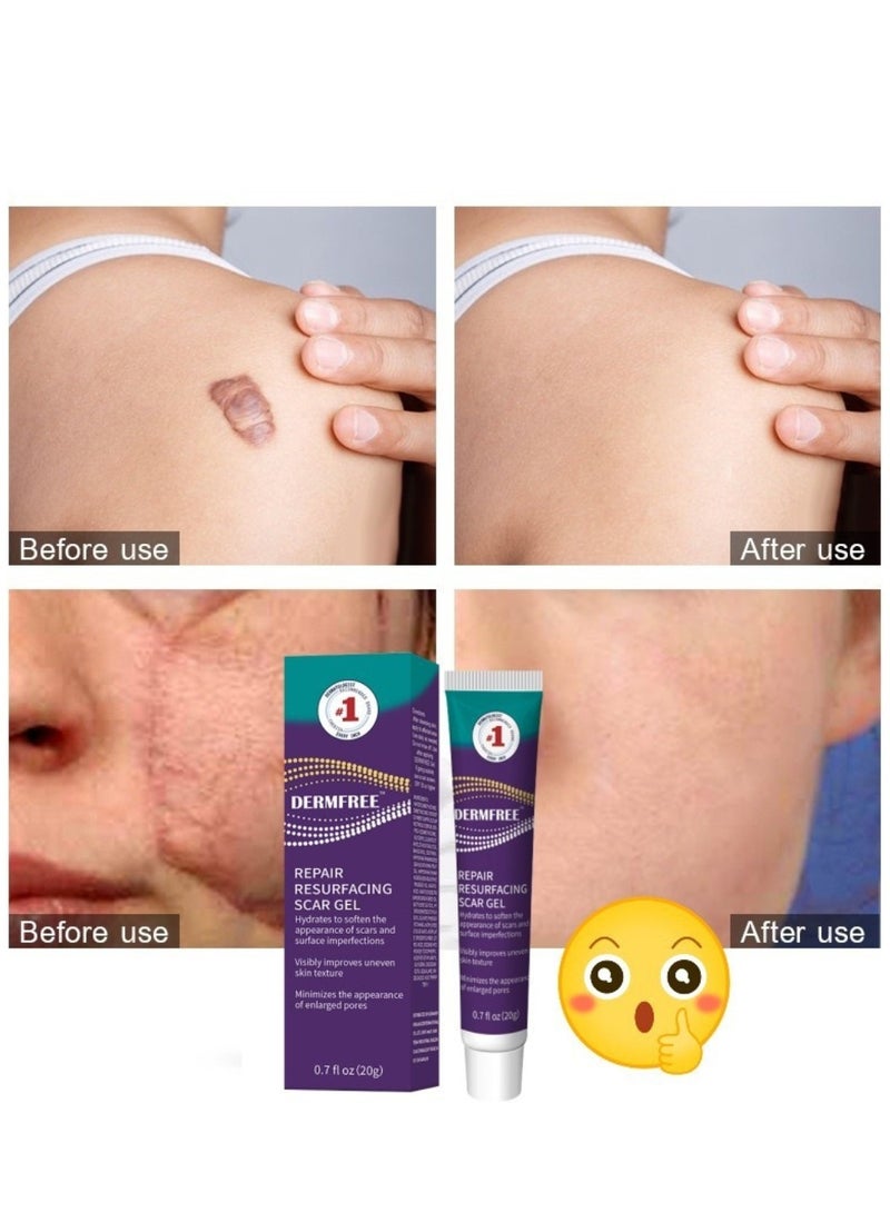 DERMFREE Repair Resurfacing Scar Gel Scar Removal Cream Reduce Scars and Marks for Dead Skin Elimination Minimize Pores Damaged Skin Acne Scars Pregnancy Lines Hydrates and Skin Repair 20g - Image 5