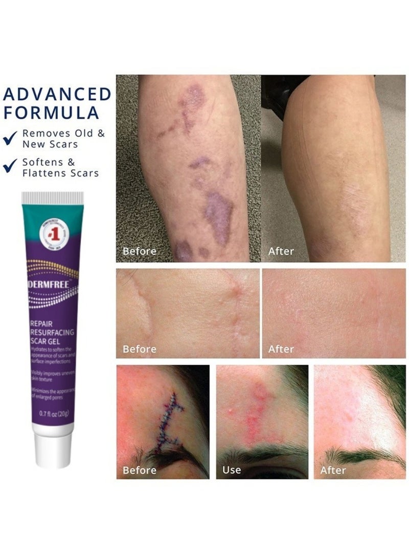DERMFREE Repair Resurfacing Scar Gel Scar Removal Cream Reduce Scars and Marks for Dead Skin Elimination Minimize Pores Damaged Skin Acne Scars Pregnancy Lines Hydrates and Skin Repair 20g - Image 4