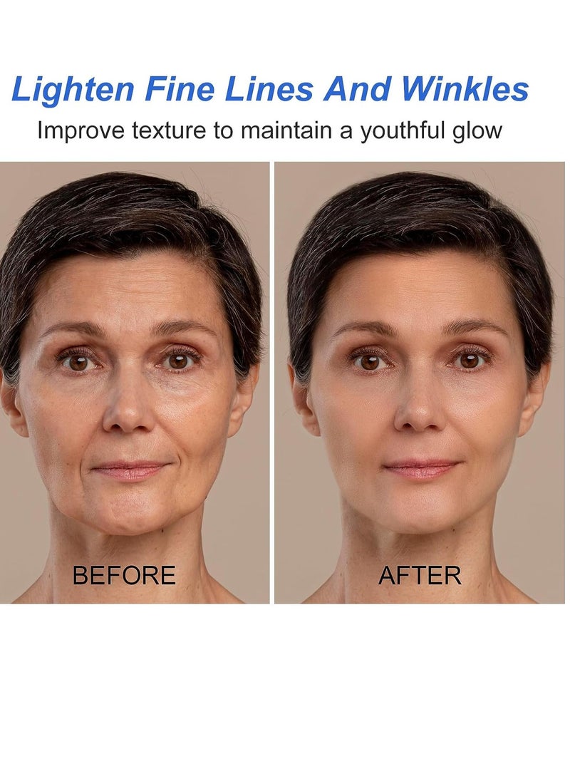 Sefudun - Botox Stock Solution Facial Serum Botox Stock Anti Aging Serum for Face Instant Face Tightening Botox Reduce Fine Lines Wrinkles Boost Skin Collagen Hydrate and Plump Skin Face Serum 30ml - Image 1