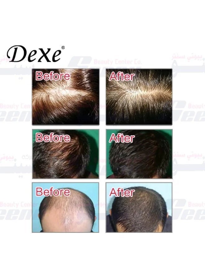 Dexe Hair Building Fibers 5 pcs Set  Instantly Conceal Hair Loss Natural Thickening Fibers Fast and Quick Hair Fiber Powder Hair Shadow Powder Hair Root Concealer Black 01 - Image 2