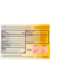 Mederma Cream 20 G ( Pack Of 2)  - Image 4