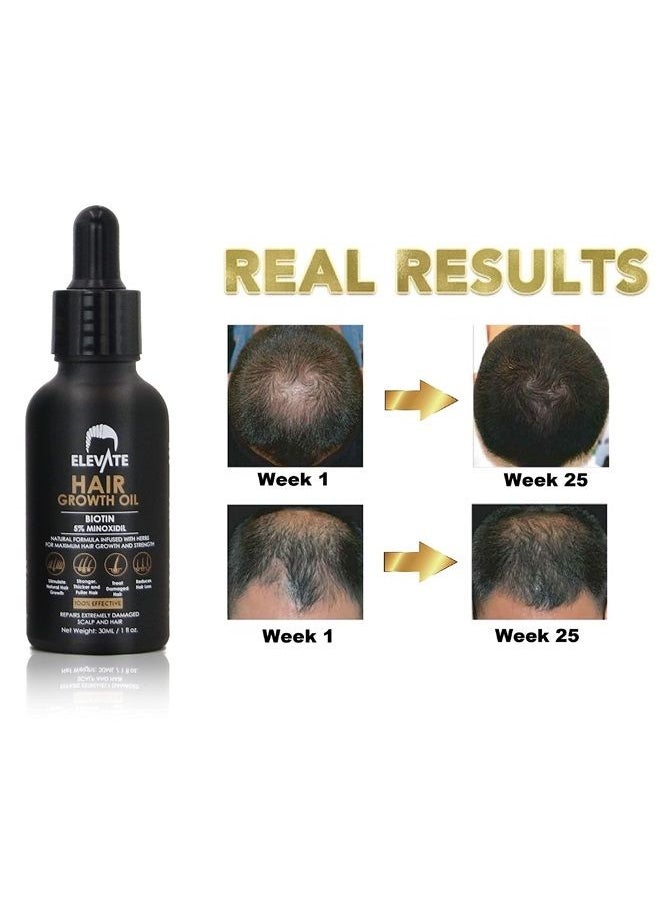 Elevate - ELEVATE Hair Growth Oil - Biotin Serum & 5% Minoxidil Treatment for Stronger Thicker Longer Hair – Natural Hair Growth Thickening Treatment - Stop Thinning & Hair Loss for Men & Women 1oz - Image 1