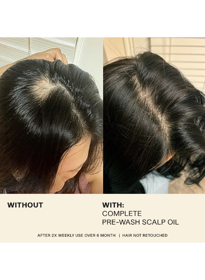 JVN Pre-Wash Scalp Oil & Hair Treatment Oil, Pre Shampoo Dry Scalp Treatment, Scalp Cleansing Oil for All Hair Types, Sulfate Free (1.7 Fl Oz) - Image 5