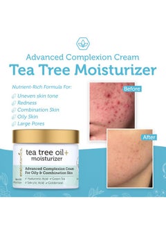 Era Organics Era Organics Tea Tree Cream Face Moisturizer for Oily Skin - Advanced 7X Balancing Oily Skin Moisturizer - Non-Greasy Moisturizer - Tea Tree Oil for Skin  - Image 5