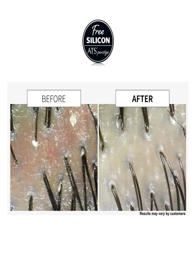 ATS Professional ATS Perstige Bresh Shampoo - 600ML, Oily Scalp and Soothing Silicone Free Shampoo - Image 3