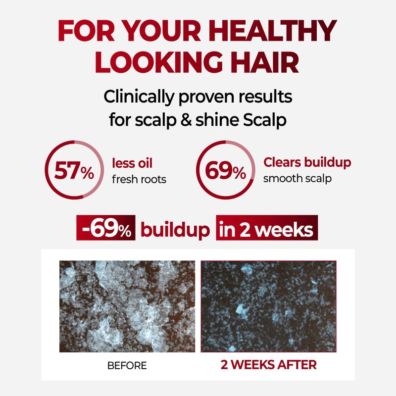 KUNDAL Korean Caffeine Scalp Shampoo [Cherry Blossom] â€“ Sulfate-Free Hair Care with Menthol & Botanical Extracts â€“ For Fuller-Looking Hair, Scalp Refresh & Strength â€“ 16.9 Fl Oz, Stocking Stuffers - Image 2