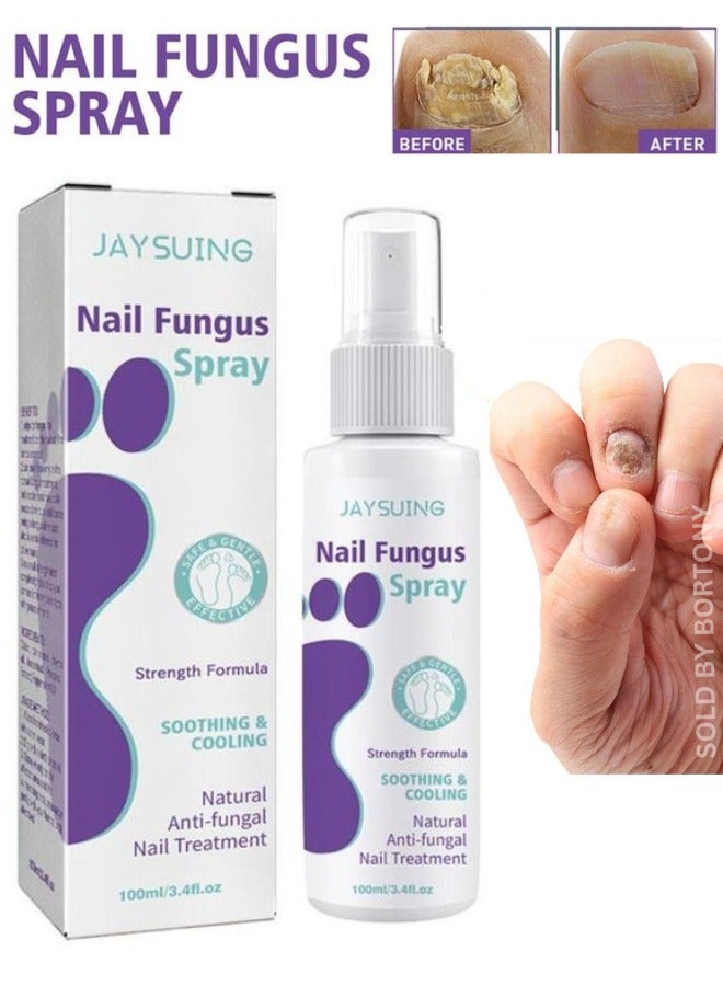 Jaysuing Nail Fungas Repair, Fungal Nail Treatment for Toenails Soothing & Cooling Anti-fungal Spray For Men & Women Feet Infections Nail Fungas Spray and Strengthener 100ml - Image 1