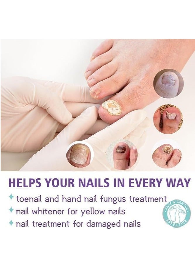 Jaysuing Nail Fungas Repair, Fungal Nail Treatment for Toenails Soothing & Cooling Anti-fungal Spray For Men & Women Feet Infections Nail Fungas Spray and Strengthener 100ml - Image 4