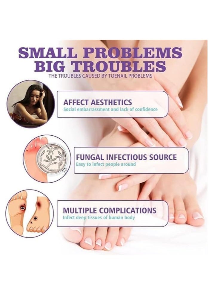 Jaysuing Nail Fungas Repair, Fungal Nail Treatment for Toenails Soothing & Cooling Anti-fungal Spray For Men & Women Feet Infections Nail Fungas Spray and Strengthener 100ml - Image 5