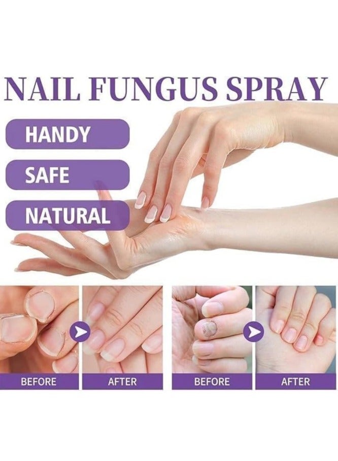 Jaysuing Nail Fungas Repair, Fungal Nail Treatment for Toenails Soothing & Cooling Anti-fungal Spray For Men & Women Feet Infections Nail Fungas Spray and Strengthener 100ml - Image 3