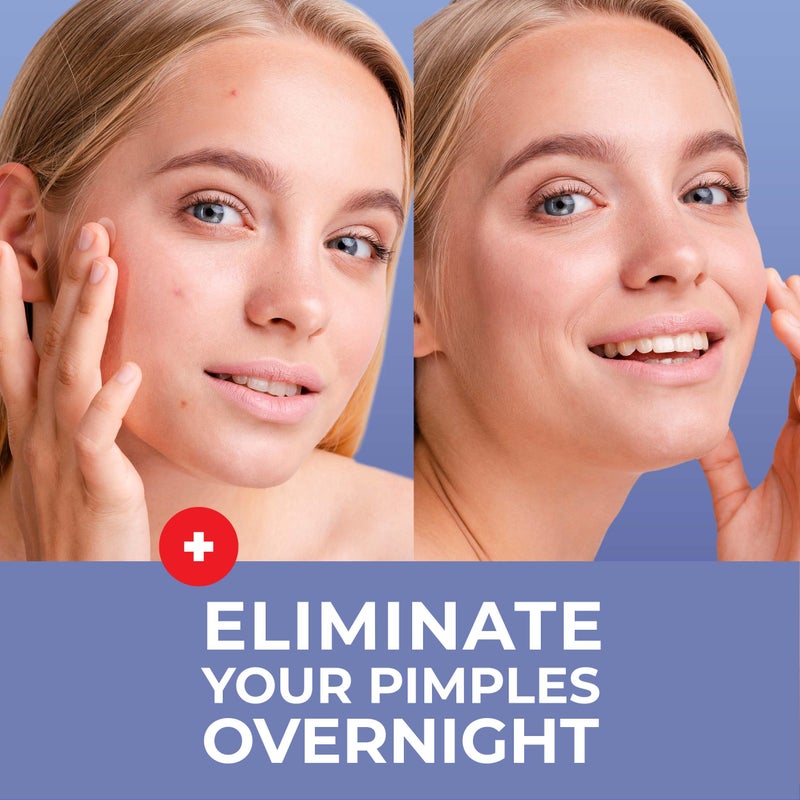 KEYCONCEPTS PatchRx Salicylic Pimple Patches (120 Pack), Salicylic Acid Acne Patches with Tea Tree Oil - Zit Patch and Pimple Stickers for Face for Skin Care - Salicylic Acid Acne Dots (Packaging May Vary) - Image 2