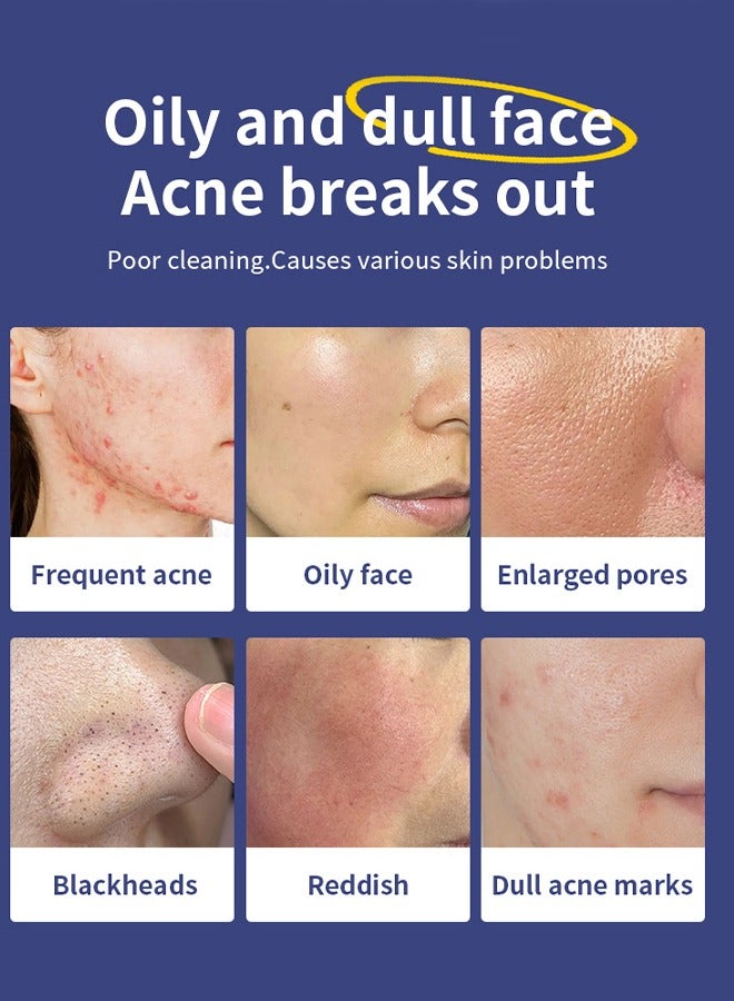 MOOYAM Salicylic Acid Cleanser - with 2% Salicylic Acid，Ceramide and Niacinamide | Gentle Foaming Face Wash for Sensitive, Acne Prone Skin | Deep Pore Cleaning | Unisex - 80g/2.82oz  - Image 2