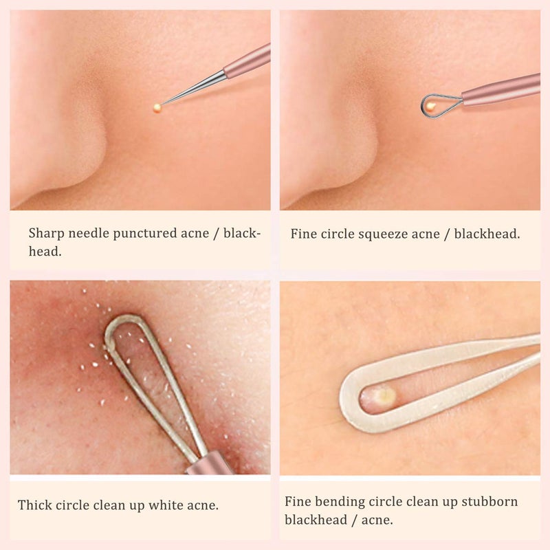 DOCOSS 5 In 1 Stainless Steel Blackhead Remover Acne Pimple Removal Acne Needle Tool Set With Metal Case Rose Gold - Image 3