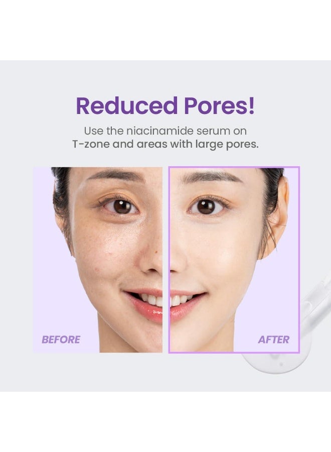 ترتر سيروم النياسيناميد 20% 30 مل - Image 4