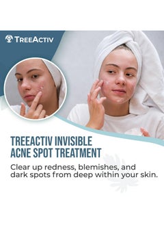 TreeActiv Invisible Acne Spot Treatment, 150+ Treatments, Salicylic Acid & Tea Tree Oil No Show Spot Treatment For Cystic & Hormonal Acne, Works For Blackheads & Whiteheads  - Image 1
