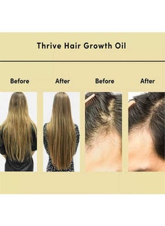 CARVENCHY Hair Growth Oil 100% Natural with Caffeine, Prevent Hair Loss, Hair Nourishing Essential Oil That Stimulates Hair Growth  - Image 5