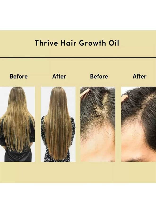 CARVENCHY - Hair Growth Oil 100% Natural with Caffeine, Prevent Hair Loss, Hair Nourishing Essential Oil That Stimulates Hair Growth - Image 1
