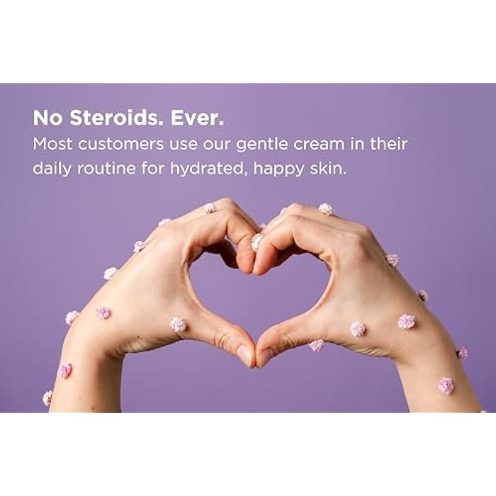 Dermgentle كريم الوجه لالتهاب الجلد الدهني للبشرة الحساسة - يرطب ويدعم حاجز البشرة بزيت MCT، سكوالان - كريم مرطب للوجه وفروة الرأس والجسم - بدون ستيرويدات، مكونات لطيفة - Image 2