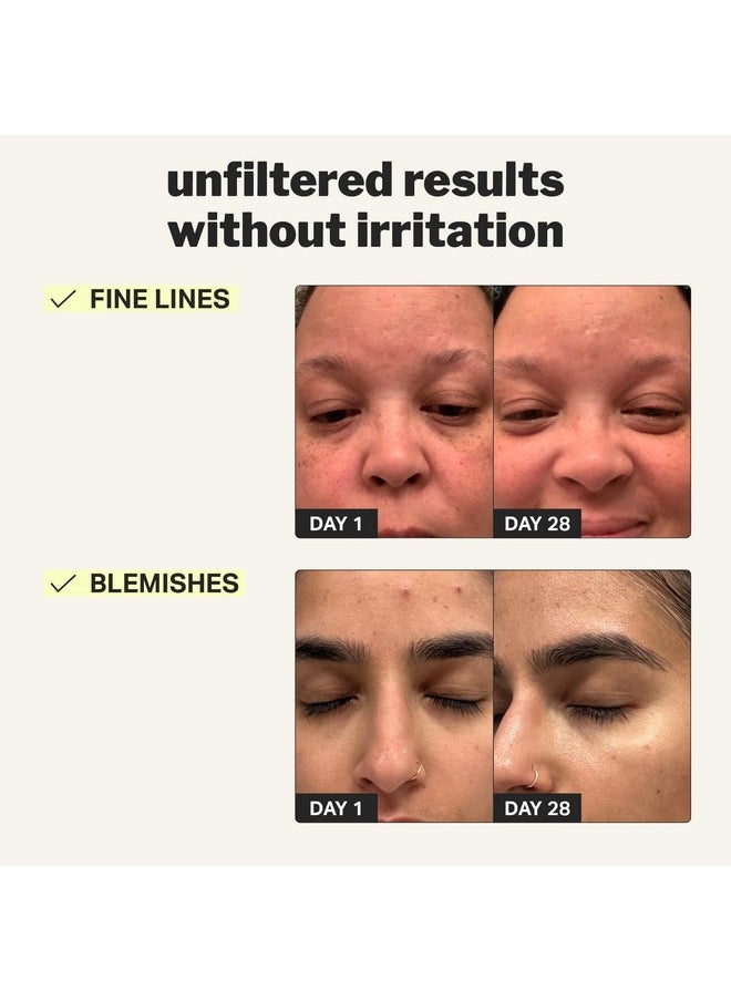 Cocokind - Beginner Retinol Gel 0.1% Improve The Appearance Of Fine Lines And Uneven Texture Without Irritation Aloe And Cica To Prevent Dryness 1 Fl Oz - Image 1