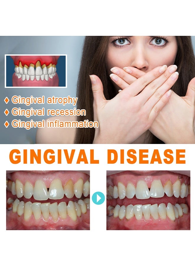 EELHOE Gum Repair Essence Ampoules, Ampoule Tooth Serum, Deep Cleaning And Gum Repair Toothpaste, Fresh Breath, Natural Ingredients, 1.5ml * 7Pcs - Image 3