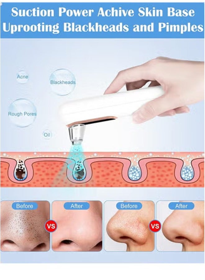 General Blackhead Remover,Vacuum Pore Blackhead Extractor,Professional Acne Extractor Tool Kits,USB Rechargeable Electric Pore Extractor for Removing Blackhead,Pimple,Grease,Whitehead  - Image 4