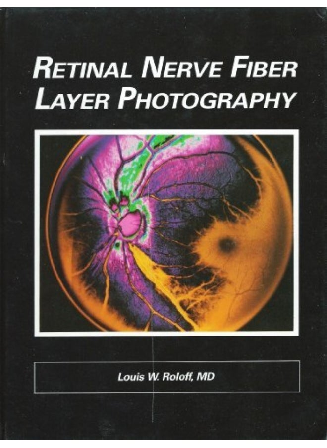 Retinal Nerve Fibre Layer Photography 