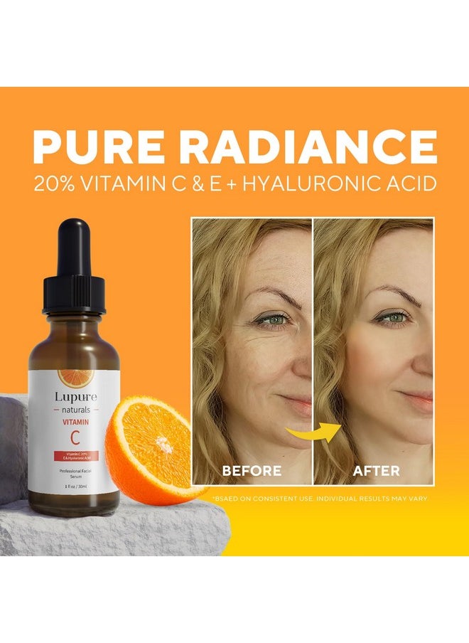 Lupure - Vitamin C Face Serum With Hyaluronic Acid: Lupure Skin Vitamin C Serum Vitamin E For Dark Spots Anti Aging Facial Serum (1 Fl Oz/ 30Ml) - Image 1