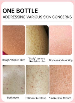 JoyPretty KP  Exfoliating Repair Cream, Exfoliate Treatment with Urea and Vitamin C, Moisturizing Hydrating Body Lotion for Dry, Rough and Bumpy Skin  - Image 3