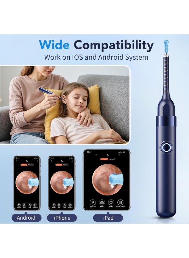 Ru syanl Smart Ear Wax Removal Kit with 1296P HD Camera, Wireless WiFi Ear Cleaner, Visual Otoscope with 6 LED Lights, Silicone Ear Pick Tool for Safe Ear Cleaning, Compatible with iPhone & Android - Image 4